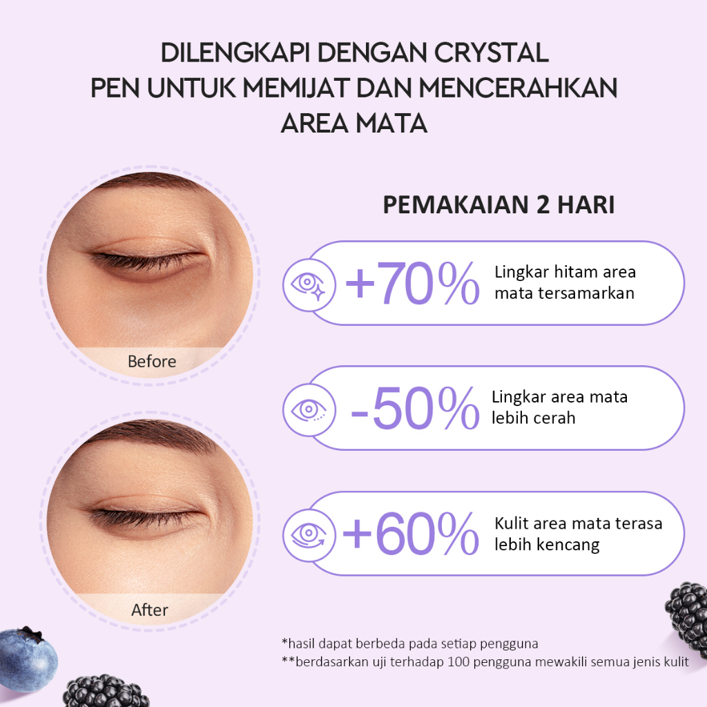 Suntone Wisdom Indonesia Glad2Glow Berry Peptide Brightening Eye Cream