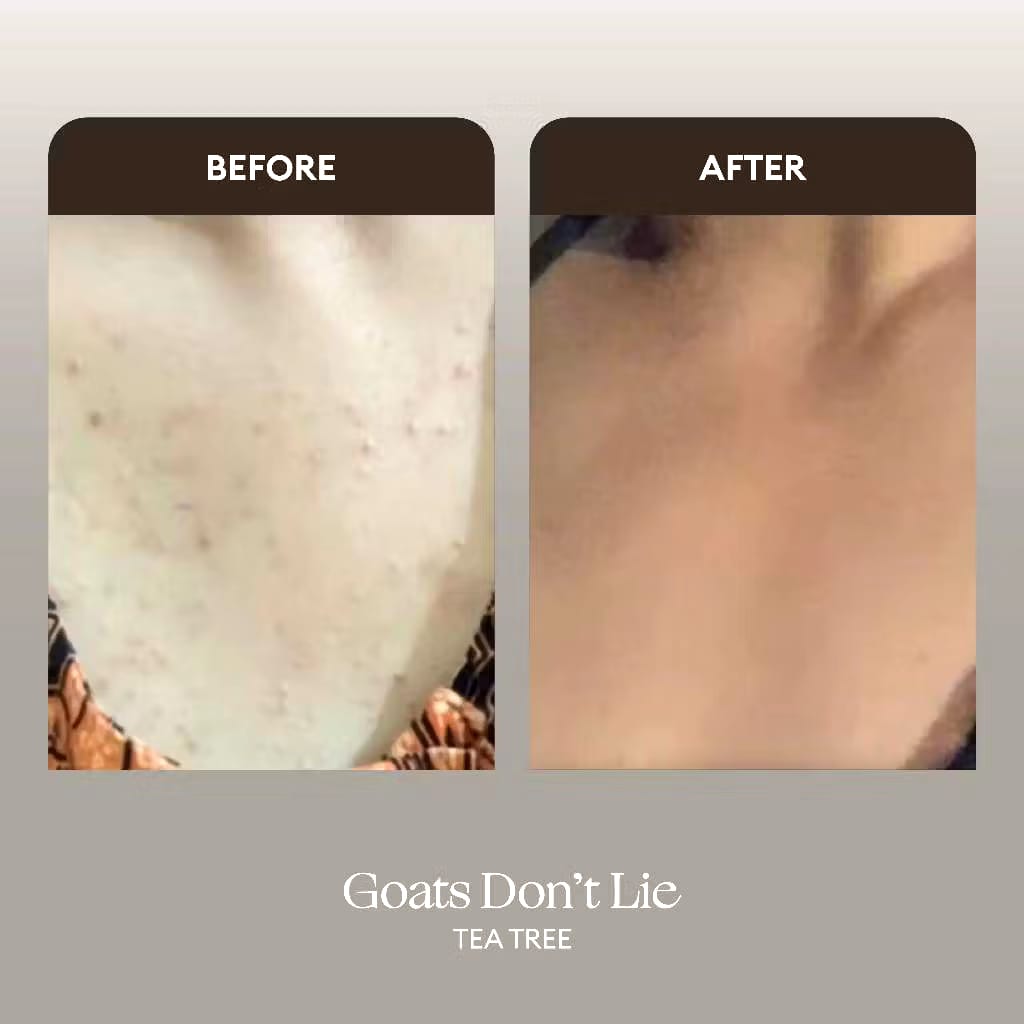 The Bath Box THE BATH BOX® Goats Don't Lie Tea Tree Liquid Soap