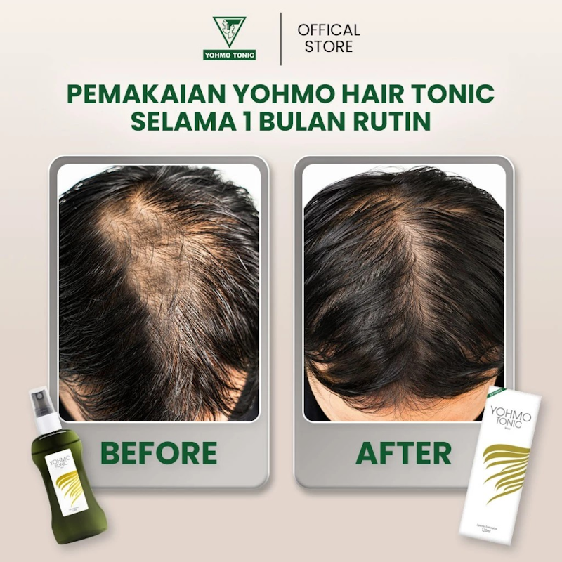 Yohmo Tonic Bloom 4