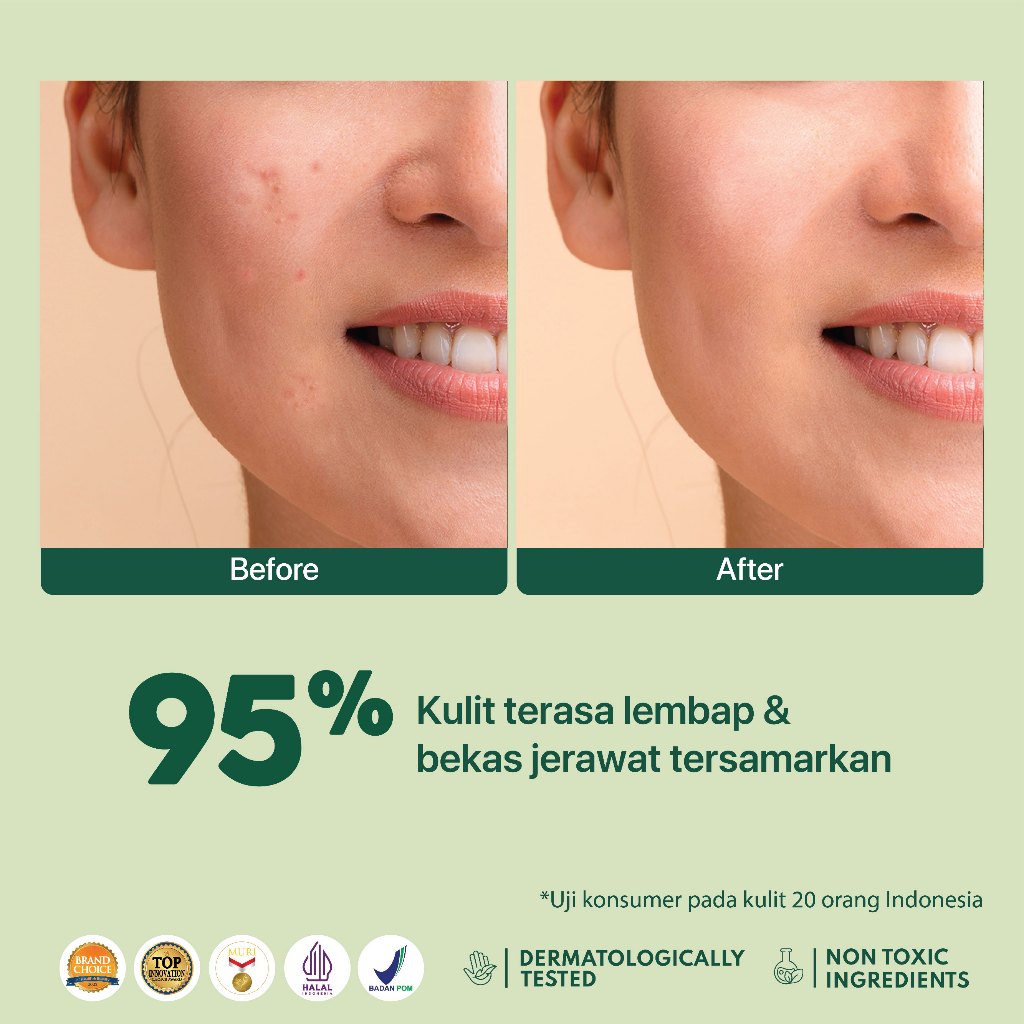 Penta Natural Kosmetindo N'PURE Centella Asiatica Acne Clear Barrier Moisturizer