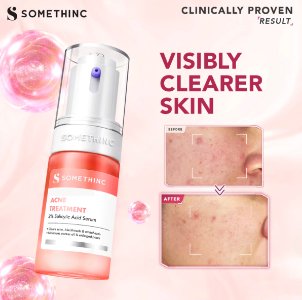 Royal Pesona Indonesia SOMETHINC Acne Treatment 2% Salicylic Acid Serum