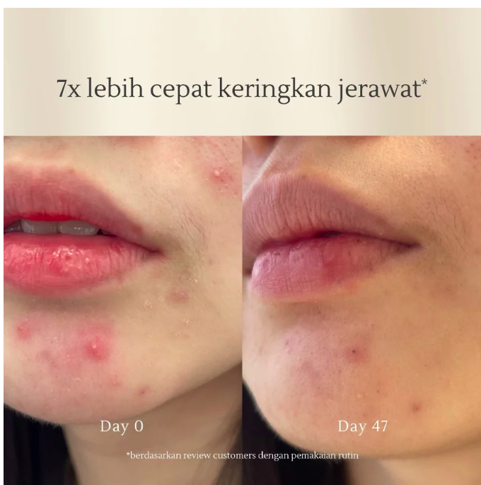 Swissvita Swissvita Acne Cleansing Cream 