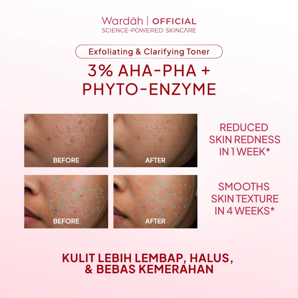 Paragon Technology and Innovation Wardah 3% AHA-PHA Phyto-Enzyme Exfoliating & Clarifying Toner