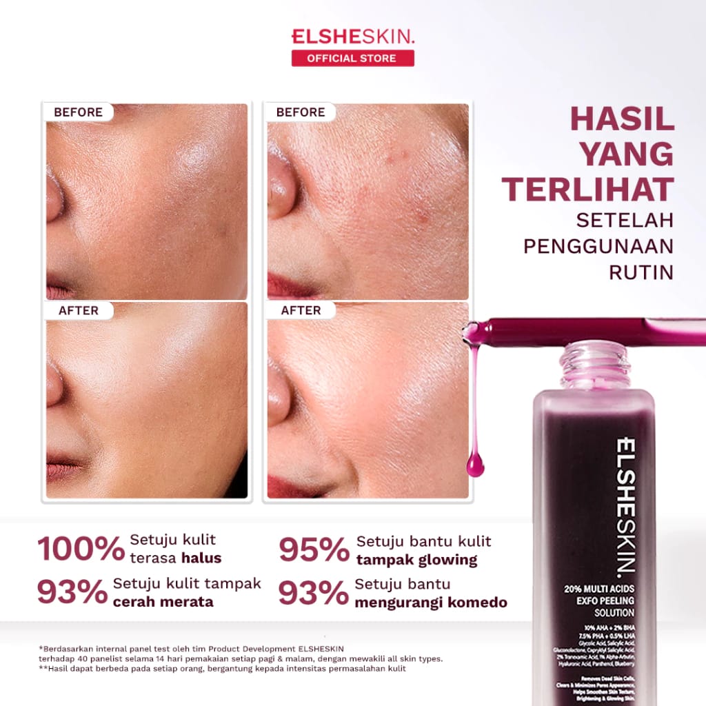 Elshe Estetika Nusantara ELSHESKIN 20% Multi Acids Exfo Peeling Solution