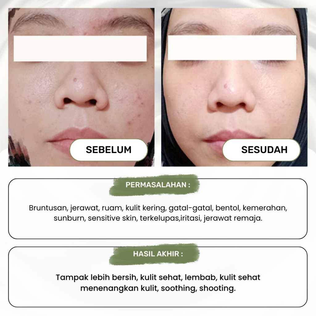 Saridewi Natural Kosmetik Skin Dewi Calendula Soothing Gel