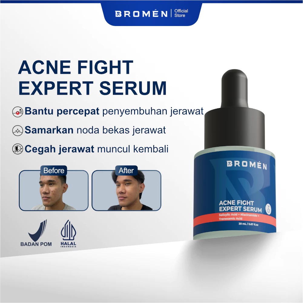 Zweena Adi Nugraha Bromen Acne Fight Expert Serum