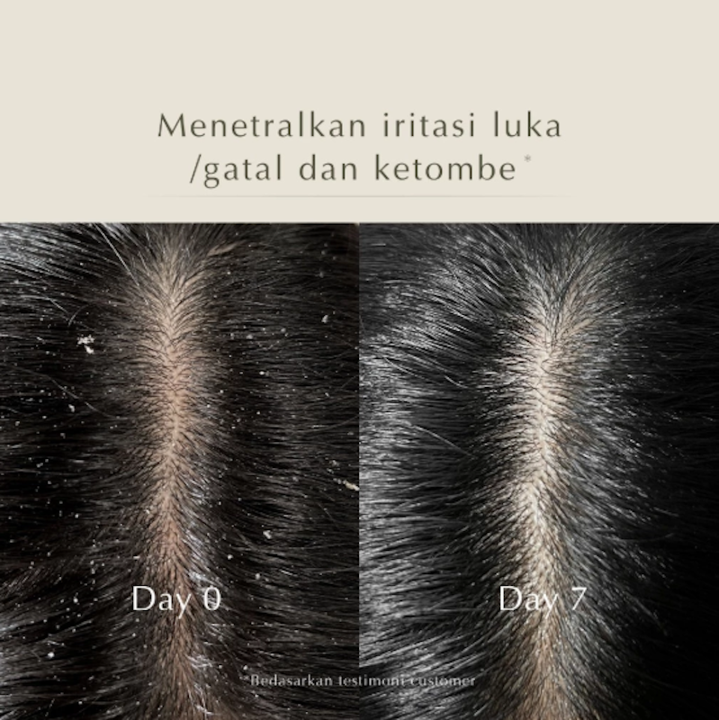 Beamarry Rosemary Tea Tree Energy Shampoo 5