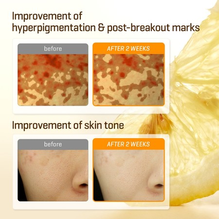 PERENNEBELL CO., LTD. SOME BY MI Yuja Niacin 30 Days Brightening Toner