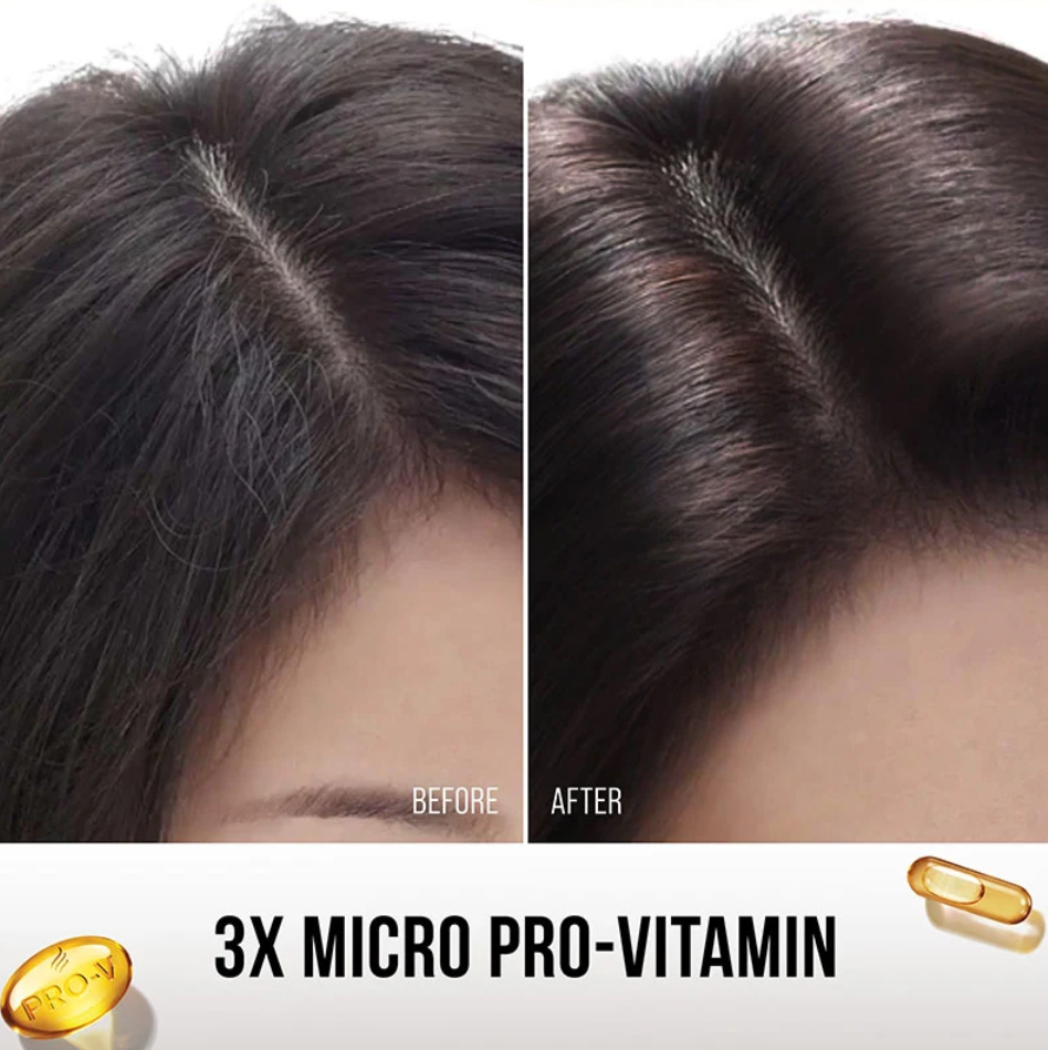 Anti Lepek Shampo Pro Vitamin 3