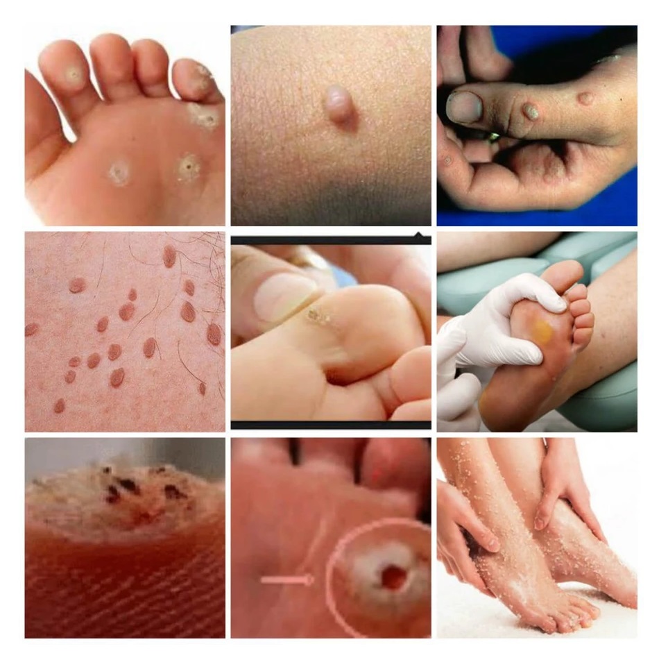  Ji Yan Gao Plester Mata Ikan