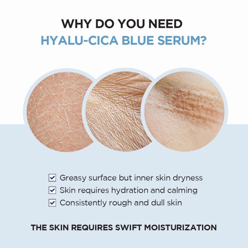 Madagascar Centella Hyalu-Cica Blue Serum 4
