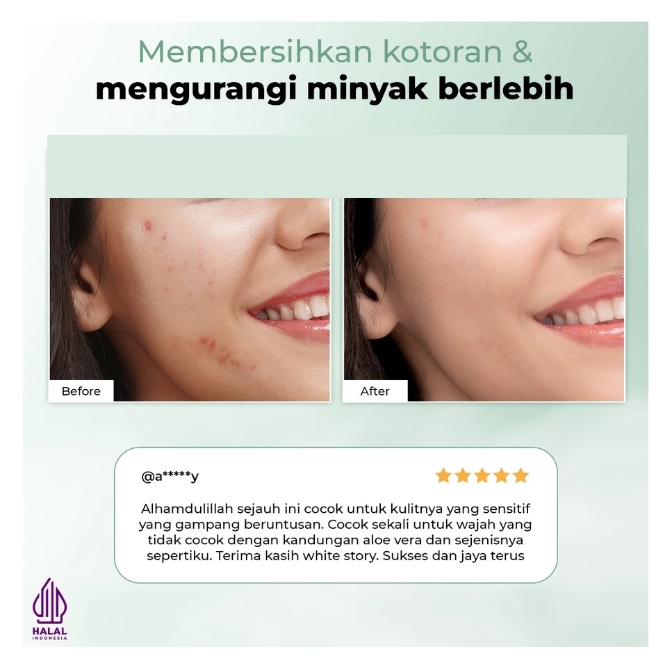 Natura Deca Kosmetika White Story Acne Facial Wash