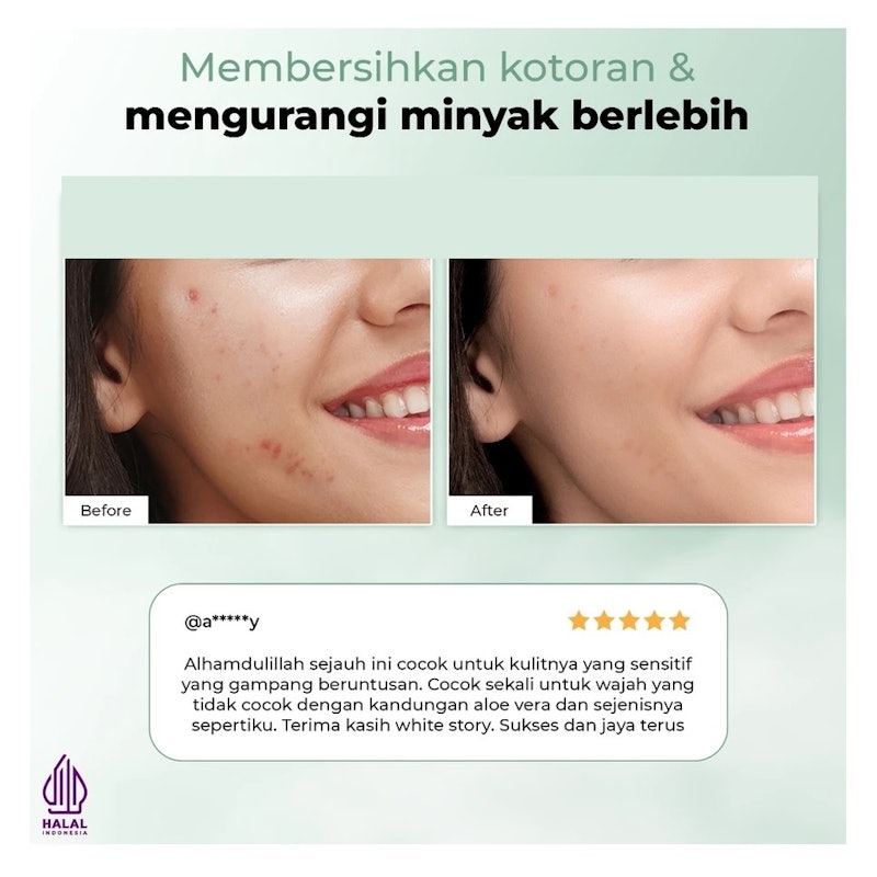 Acne Facial Wash 5