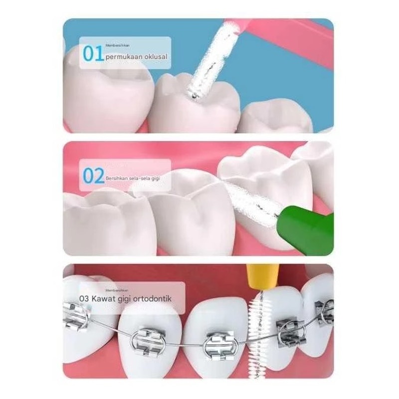 ASM Interdental Brush Orthodontics 0.6 mm 5