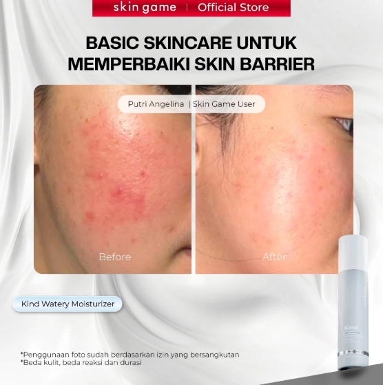 Derawa Usaha Adiratna Skin Game Kind Watery Moisturizer 