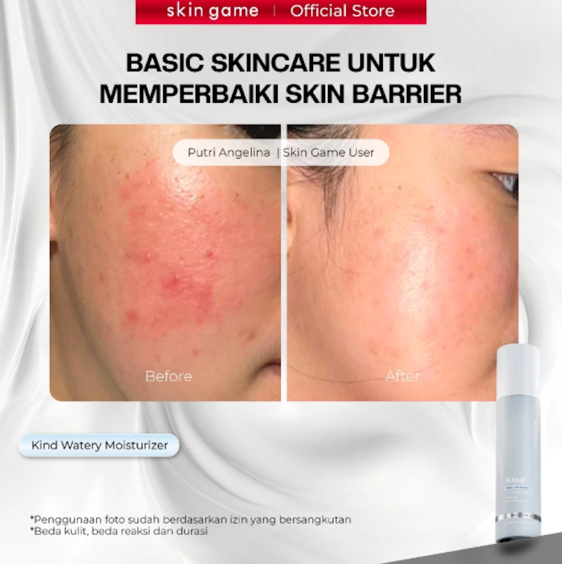 Skin Game Kind Watery Moisturizer 5