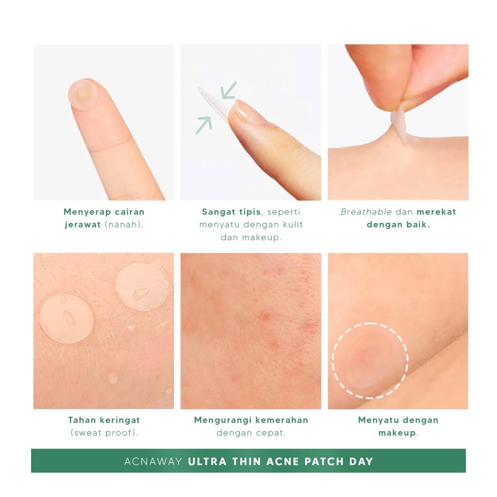  ACNAWAY Ultra Thin Acne Patch