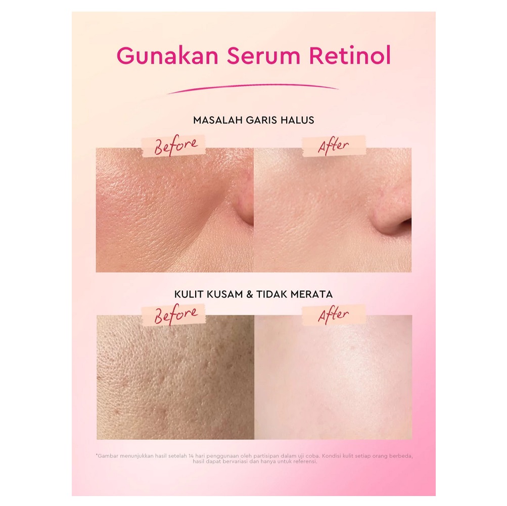 Suntone Wisdom Indonesia Glad2Glow Peach Retinol Serum