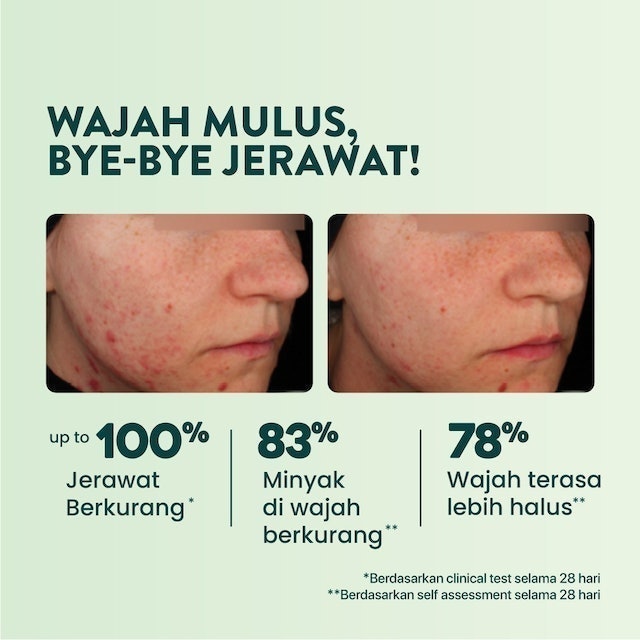 N'Pure Cica Biome Acne Serum Essence