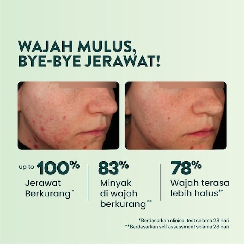 Cica Biome Acne Serum Essence 4