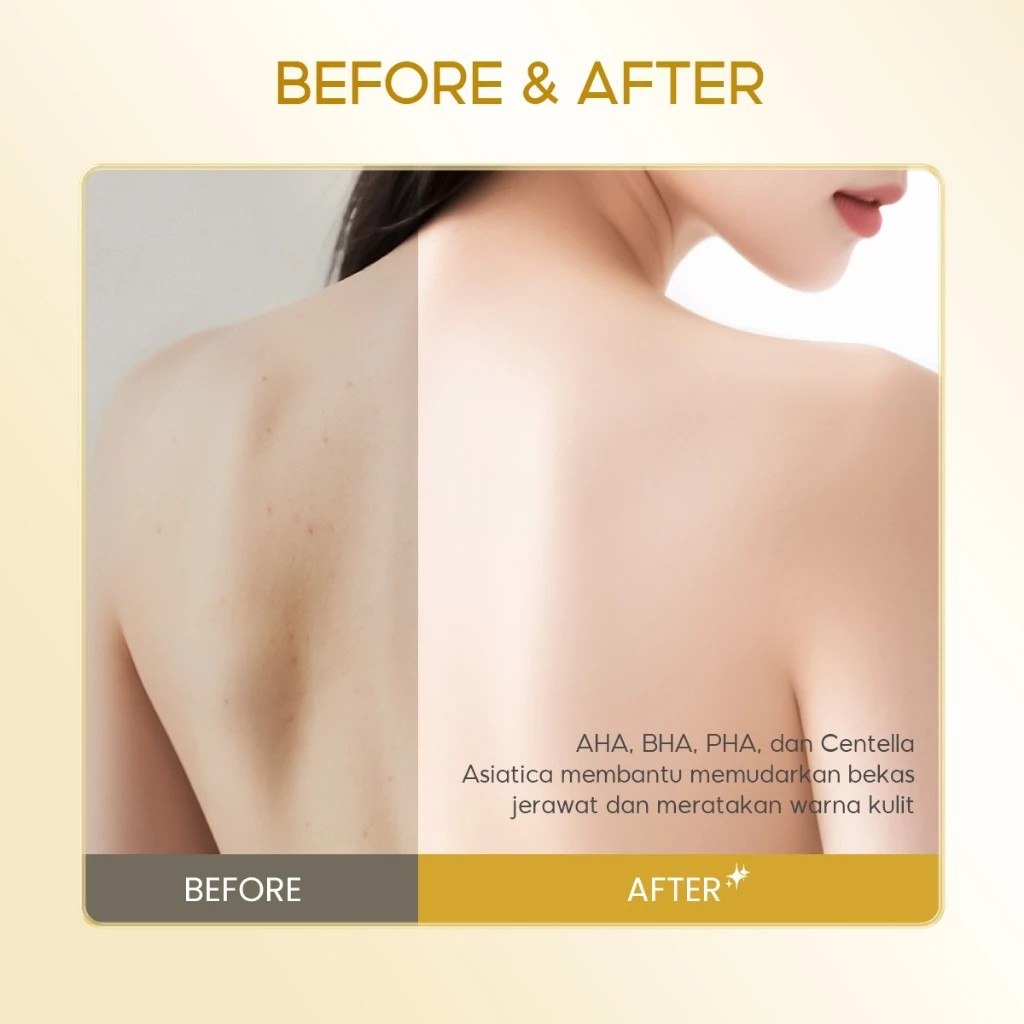 Grace and Glow Grace and Glow English Pear and Freesia Anti Acne Solution Body Wash