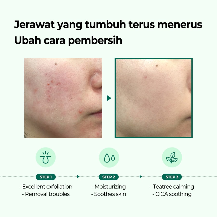 SOME BY MI AHA BHA PHA 30 Days Miracle Cleansing Bar