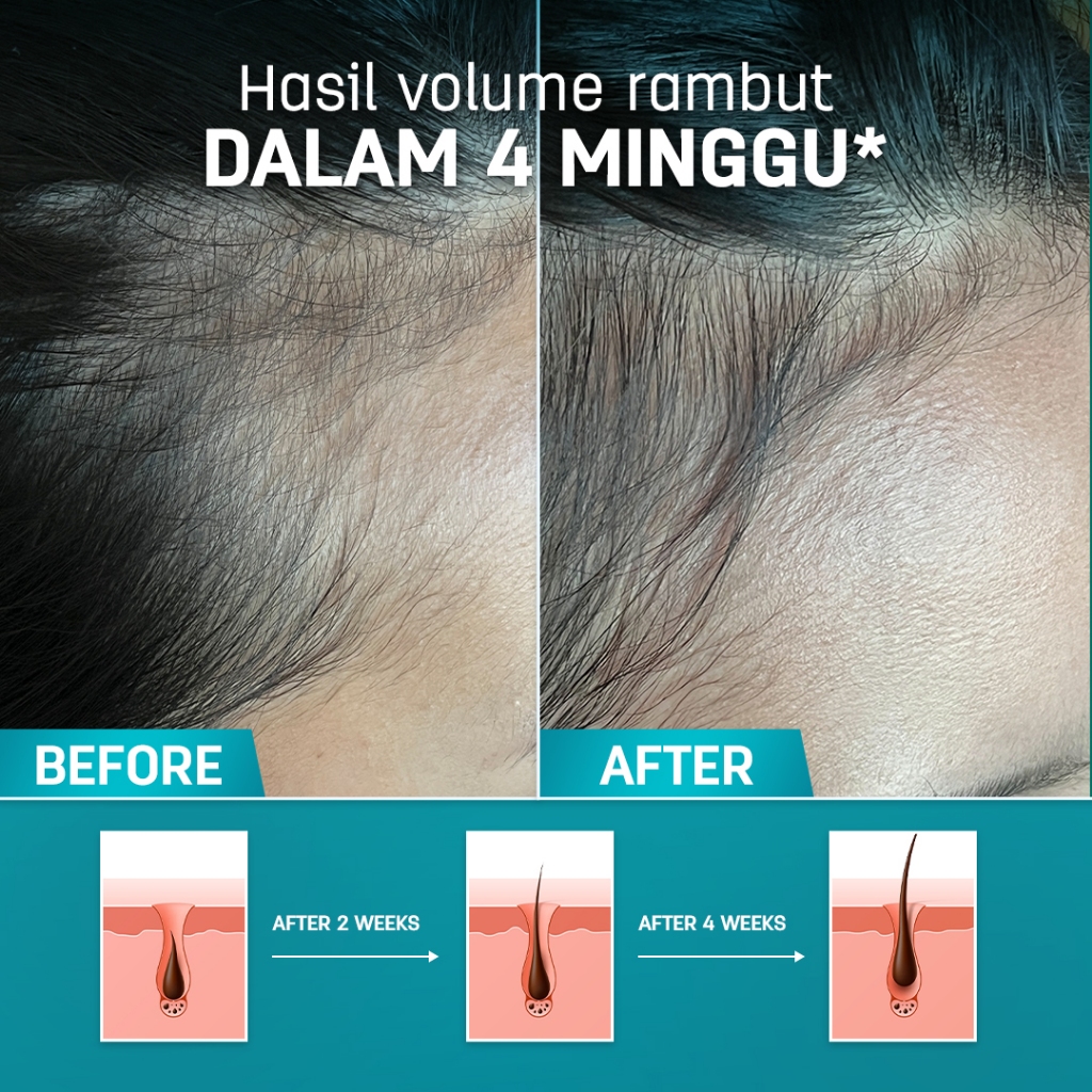 ERHA Clinic Indonesia Erhair HairGrow Hair Fall Protection Serum