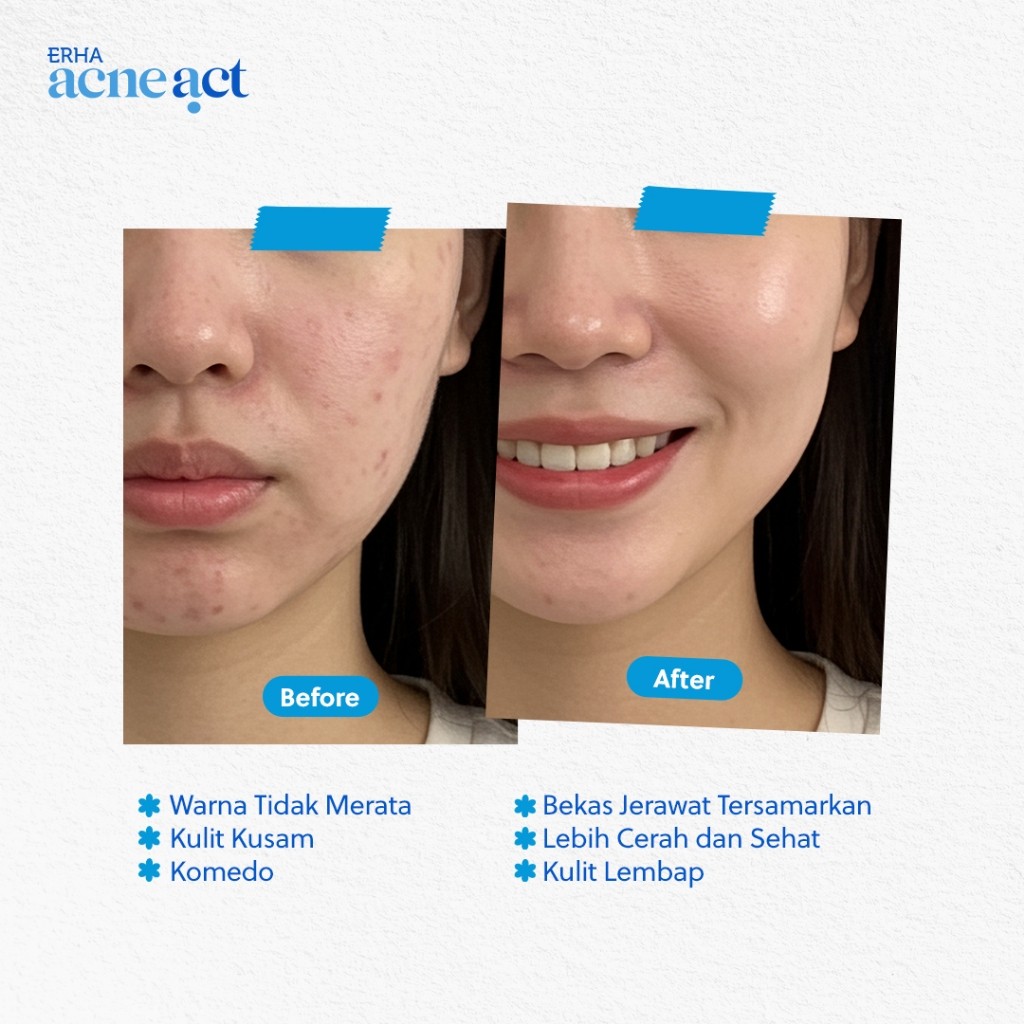 Acneact Acne Loose Powder 4