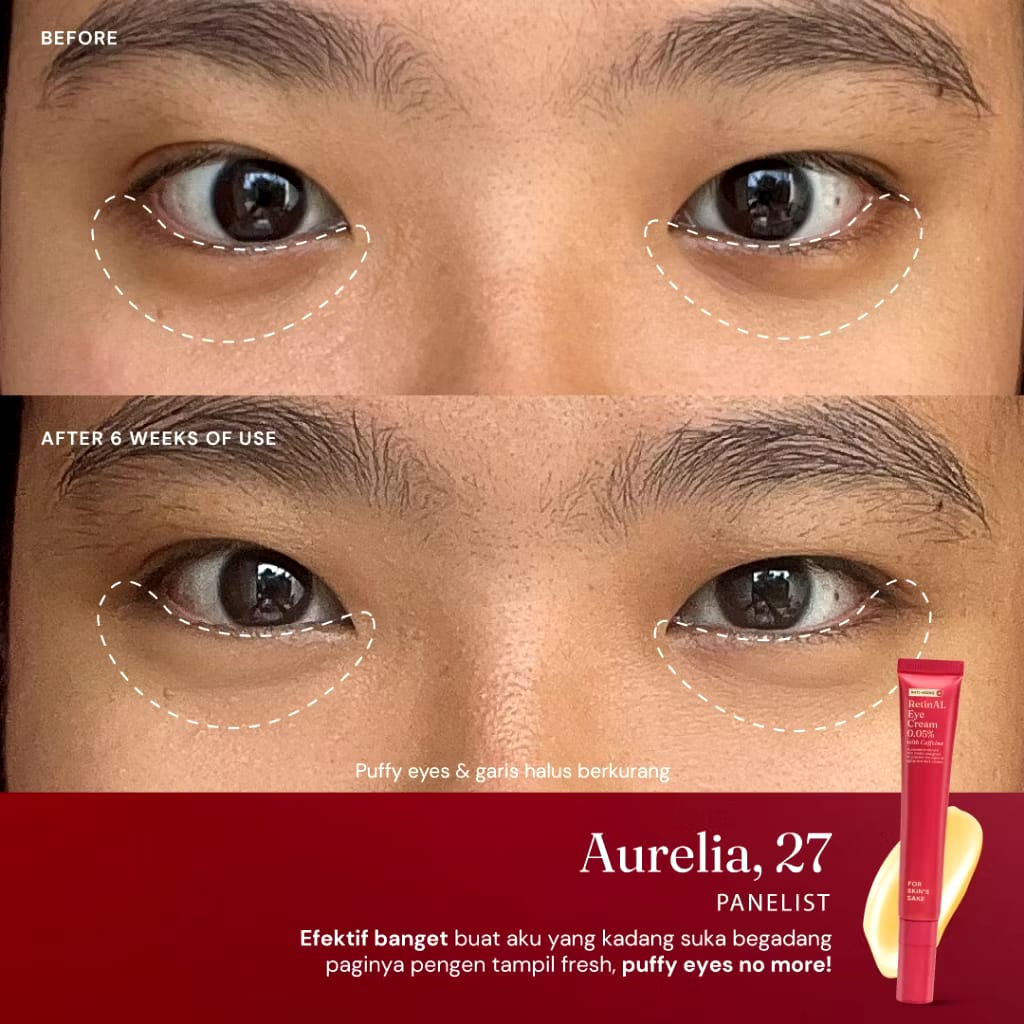 Pillar Brite Care For Skin's Sake RetinAL Eye Cream 0.05% with Caffeine