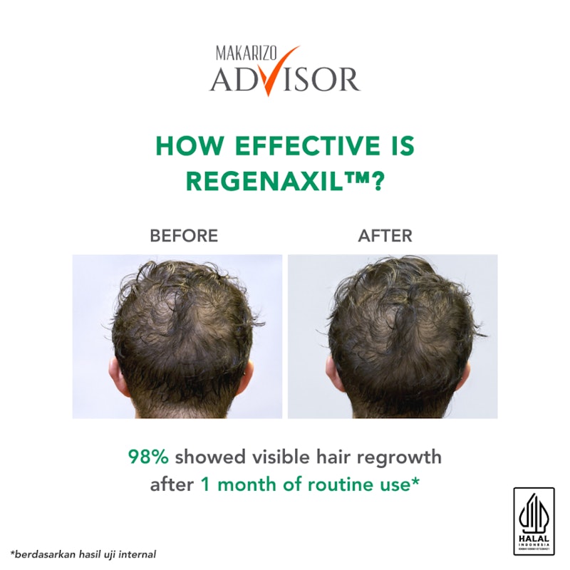 RX Strong Hair Expert Care Scalp Serum 5