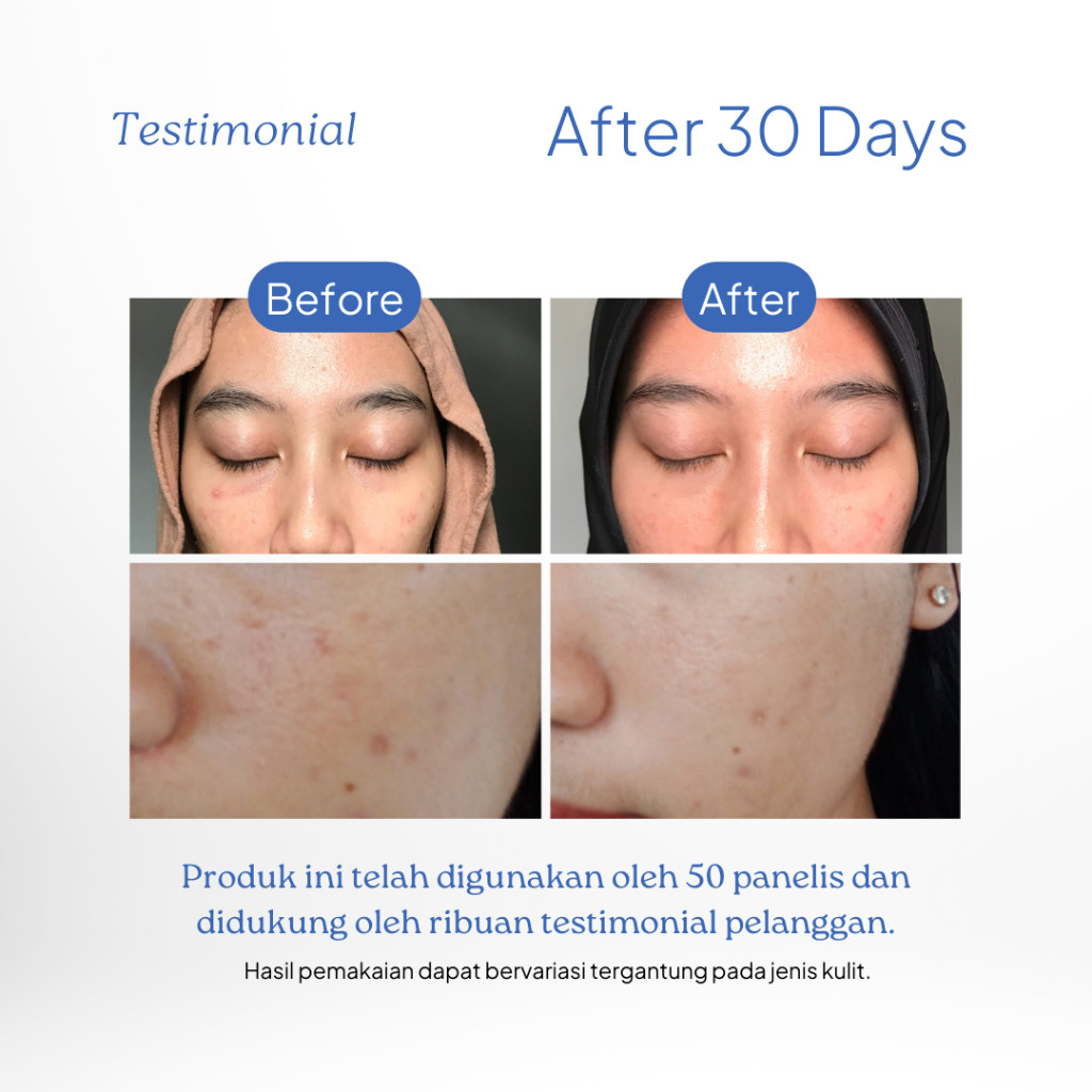 Dorskin Kreasi Indonesia dörskin Hydra Moiscreen SPF 50 PA+++