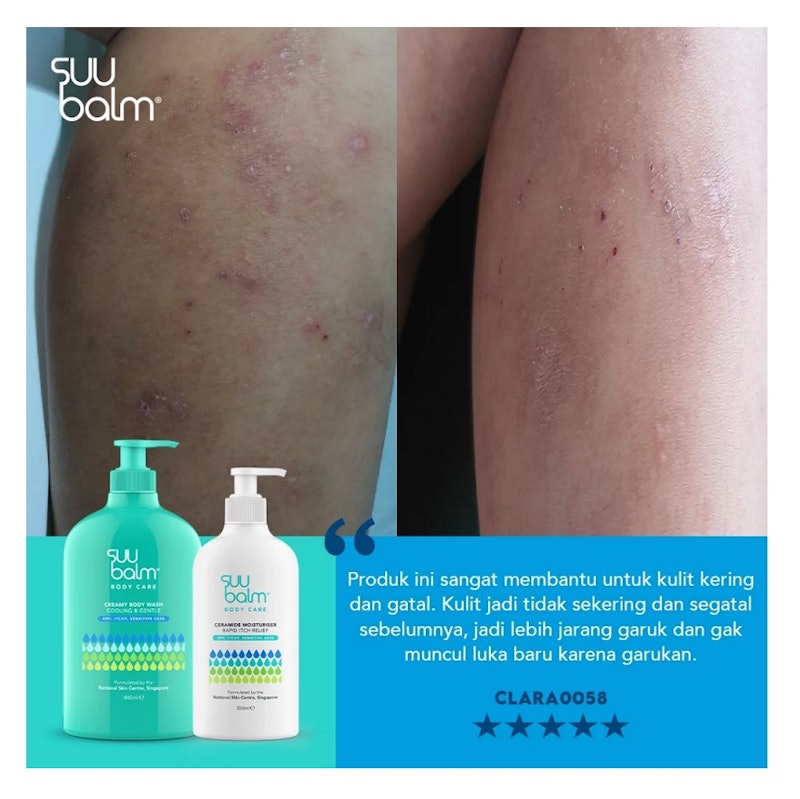 Suu Balm Ceramide Moisturiser Rapid Itch Relief 5