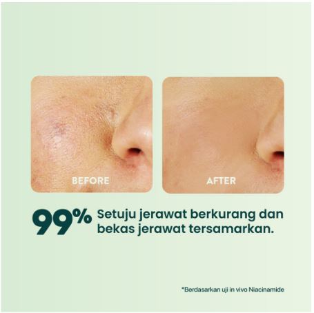 Penta Natural Kosmetindo N'PURE Cica Face Sheet Mask