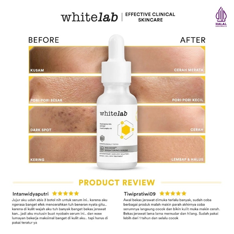 N10-Dose+ 2.0 Intense Brightening Serum Niacinamide 10% 5