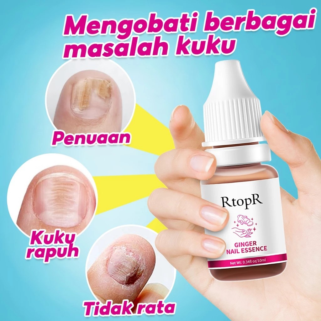 Guangzhou Tata Biotechnology RtopR Ginger Nail Essence