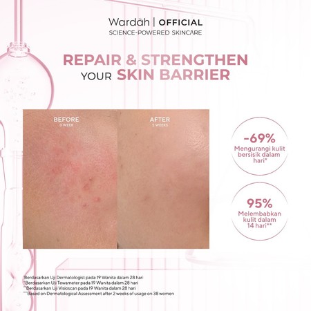 Paragon Technology and Innovation Wardah Hydra Rose 14X Hyaluronic Pentavitin Deep Barrier Repair Serum 