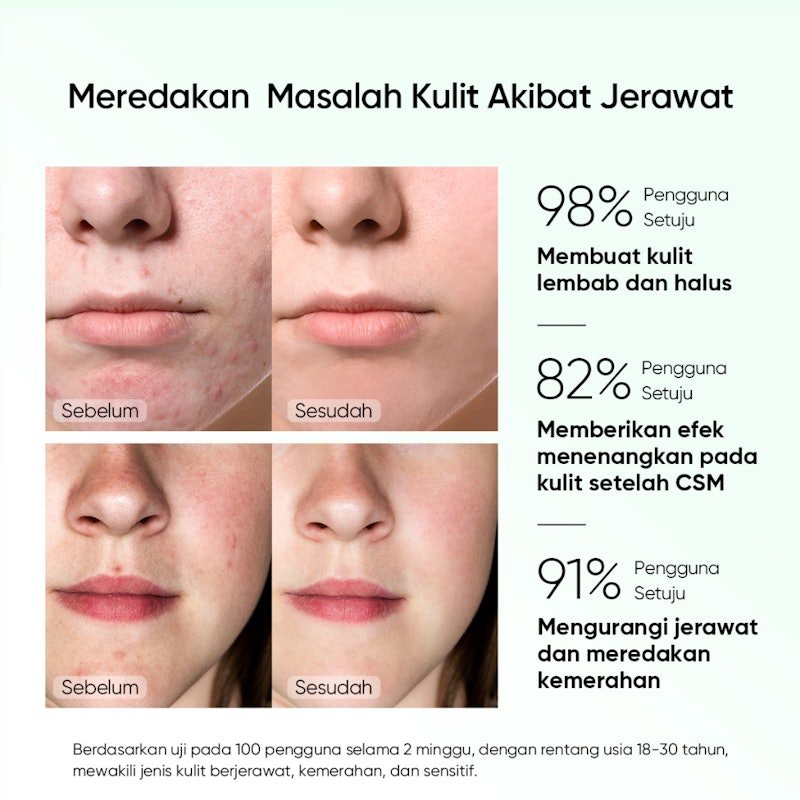 Pure Centella Acne Calming Toner 5