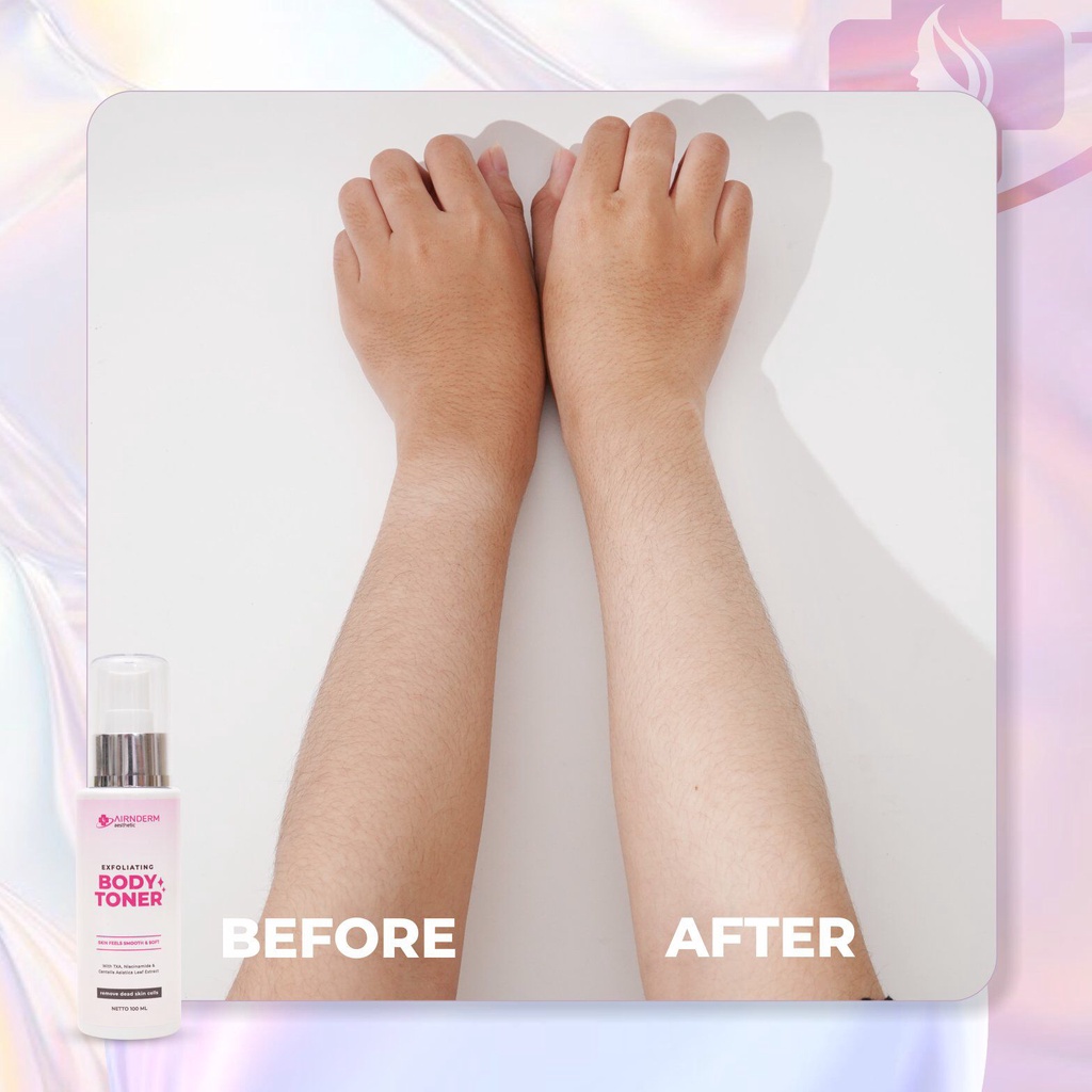 Airnderm Aesthetic Exfoliating Body Toner