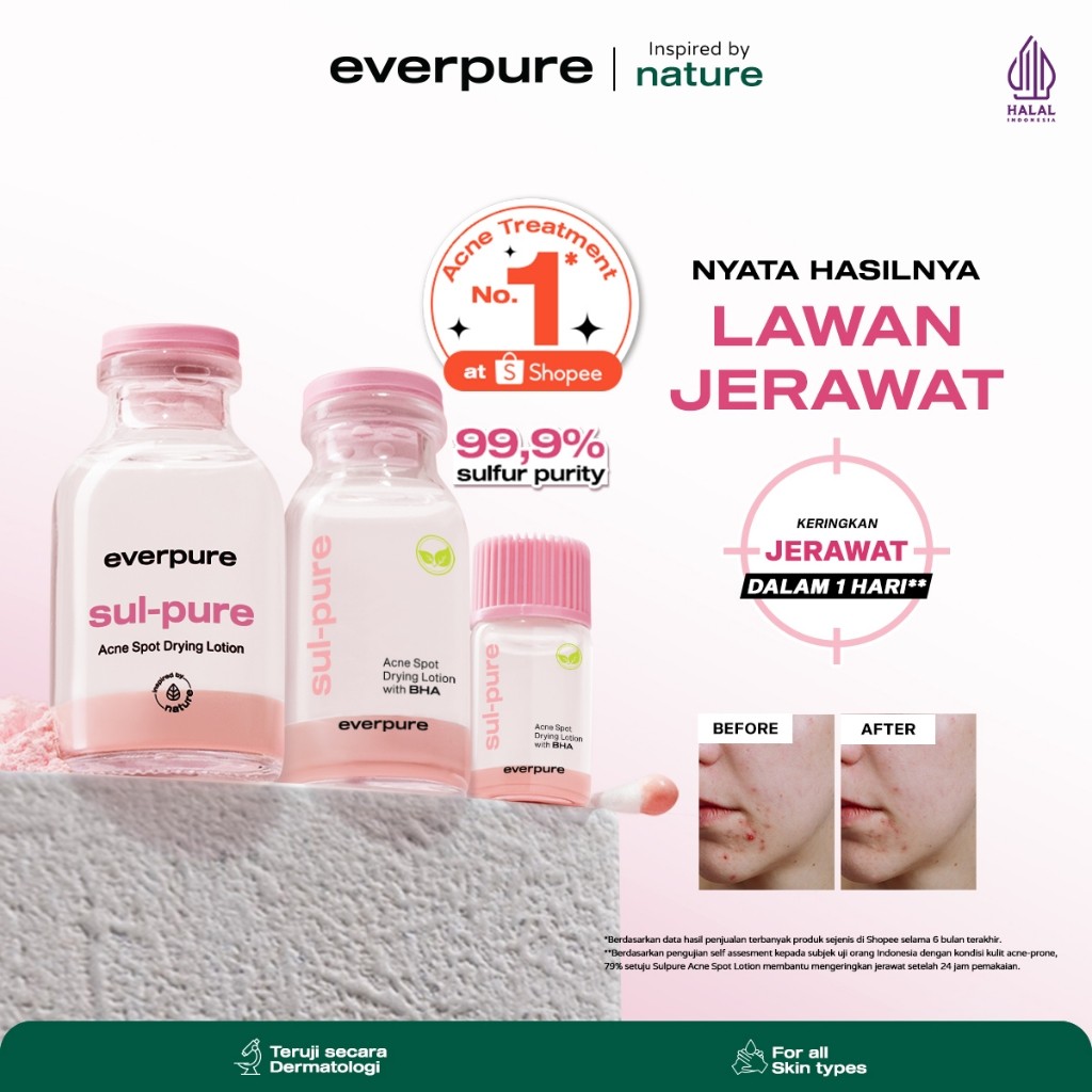 Natura Deca Kosmetika Everpure Sul-pure Acne Spot Drying Lotion