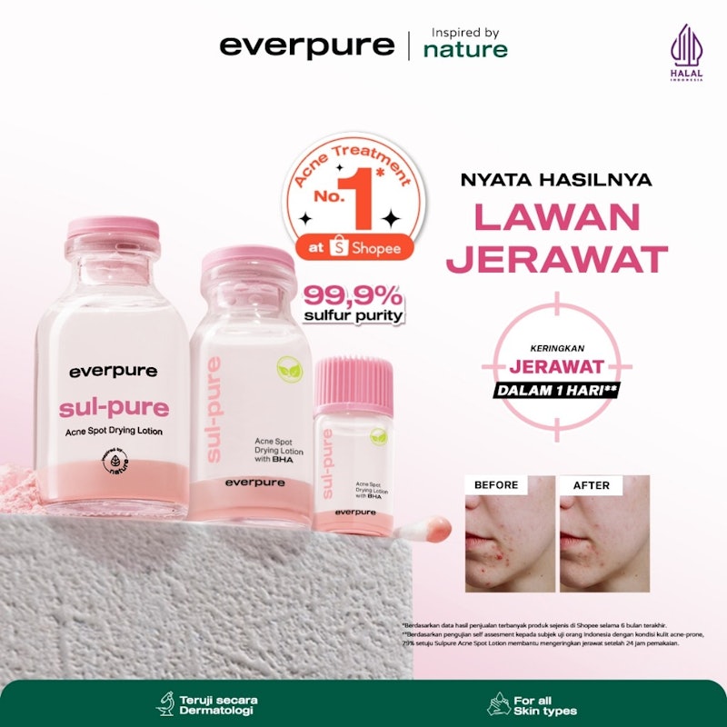 Sul-pure Acne Spot Drying Lotion with BHA 2