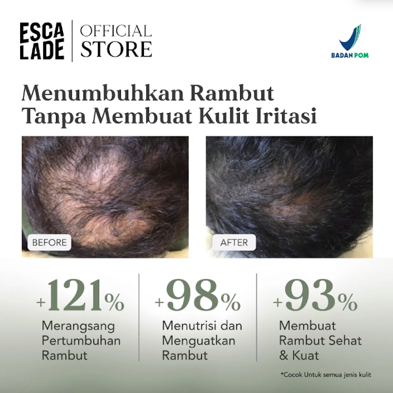 ESCALADE Loss Less Hair Thickening Serum 4