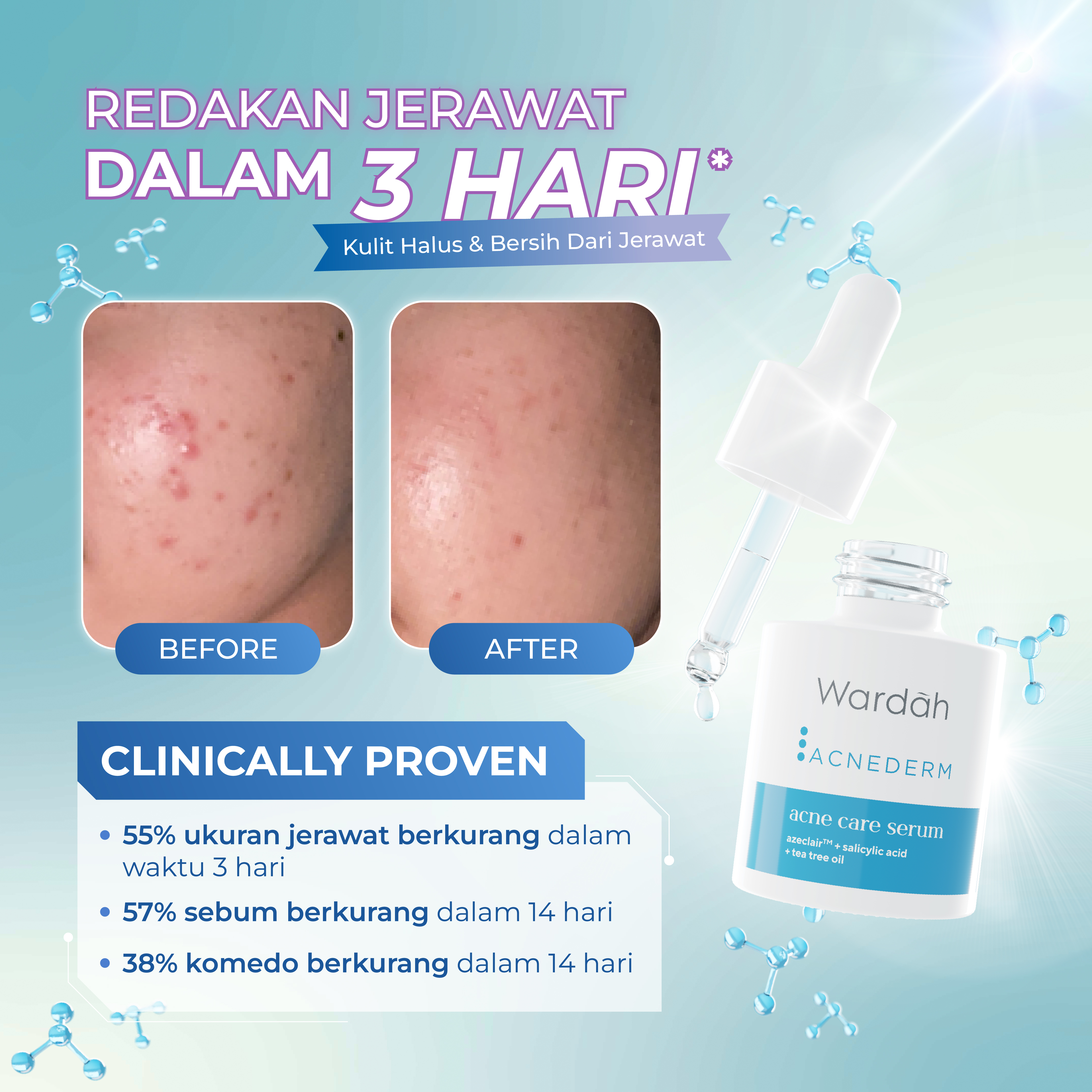 Paragon Technology and Innovation Wardah Acnederm Acne Care Serum