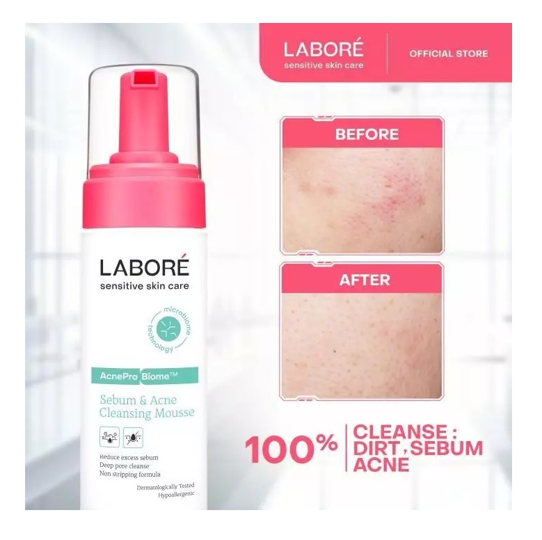Paragon Technology and Innovation LABORÉ Sensitive Skin Care AcnePro Biome Sebum & Acne Cleansing Mousse