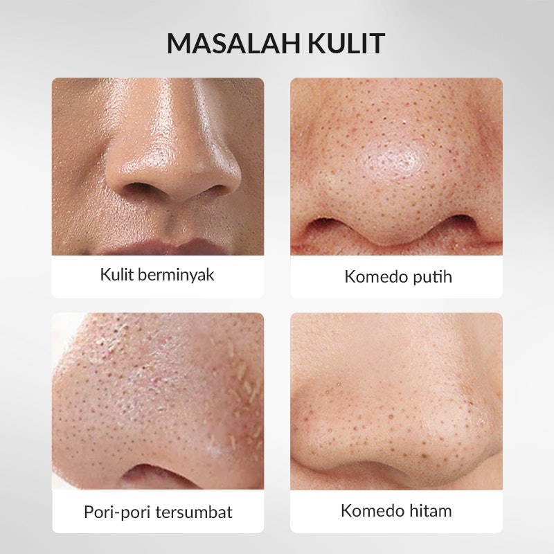 Blackhead Charcoal Peel Off Mask 5
