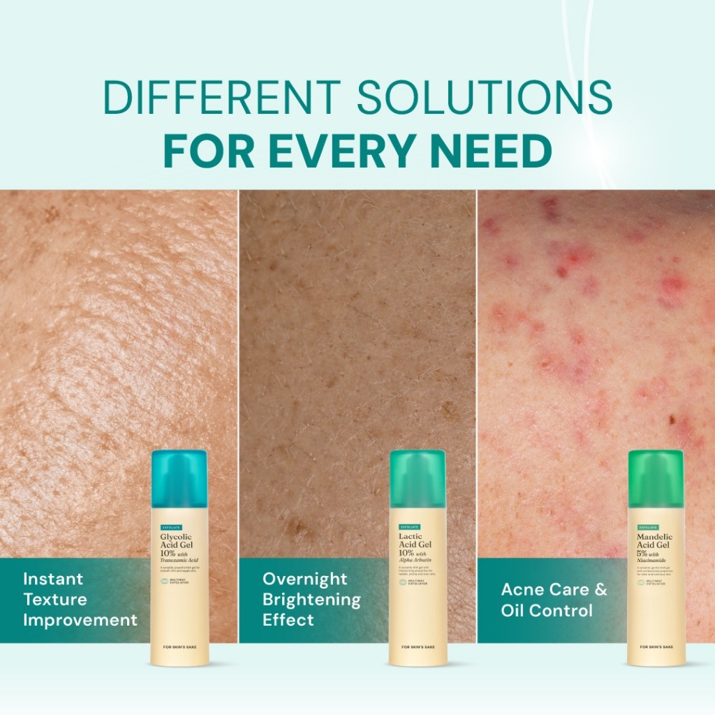 For Skin's Sake Mandelic Acid Gel 5% with Niacinamide 5