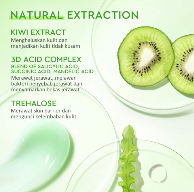 Suntone Wisdom Indonesia Glad2Glow Kiwi 3D Acid Acne Moisturizer