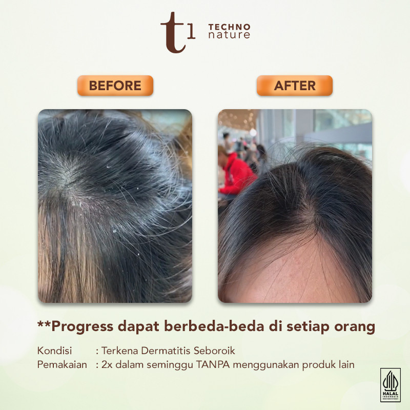 Akasha Wira International Makarizo T1 Techno Nature Equalizer Conditioner