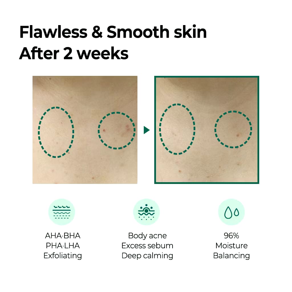 Perennbell SOME BY MI AHA BHA PHA Miracle Calming Body Lotion