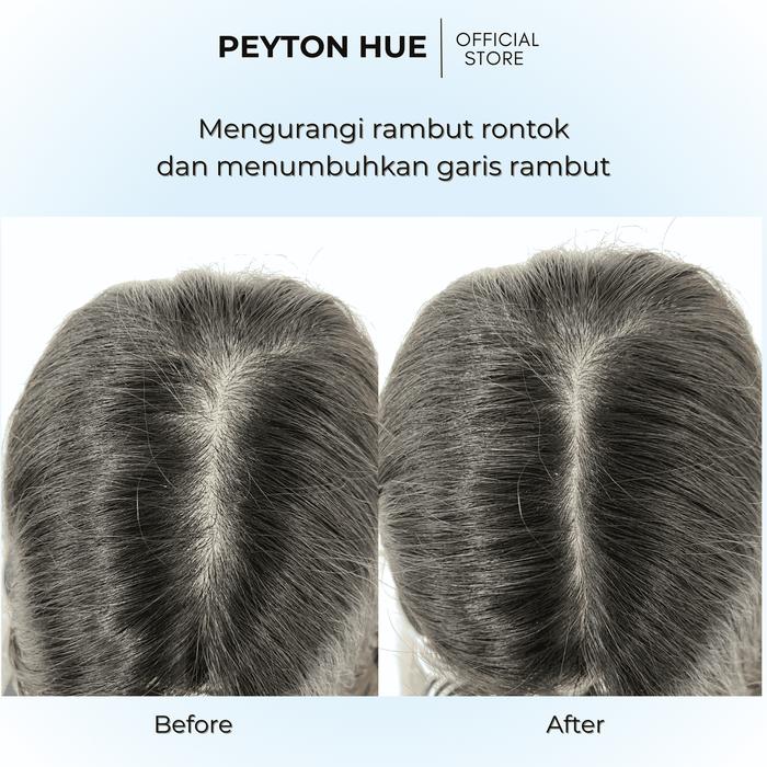 Peyton Hue Gentle Rosemary Oil 4