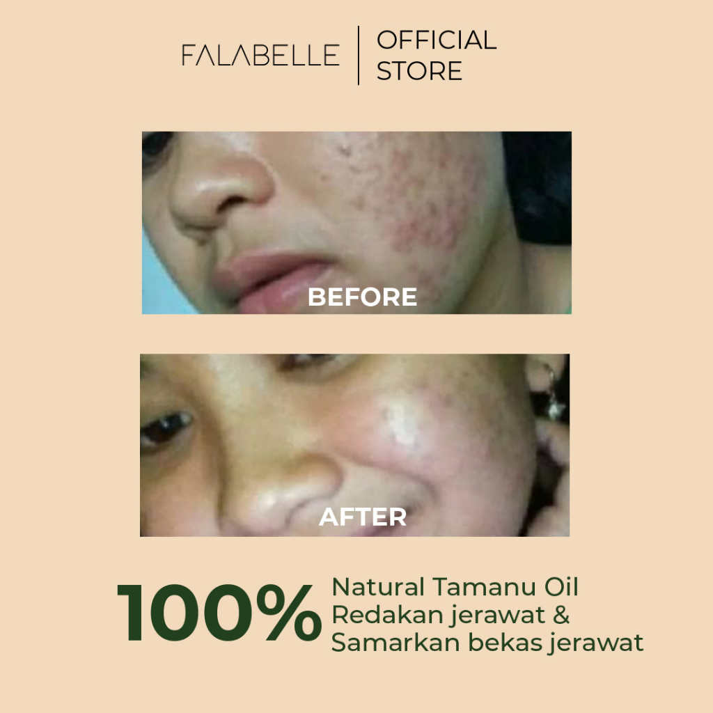 Nose Herbalindo Falabelle Tamanu Oil